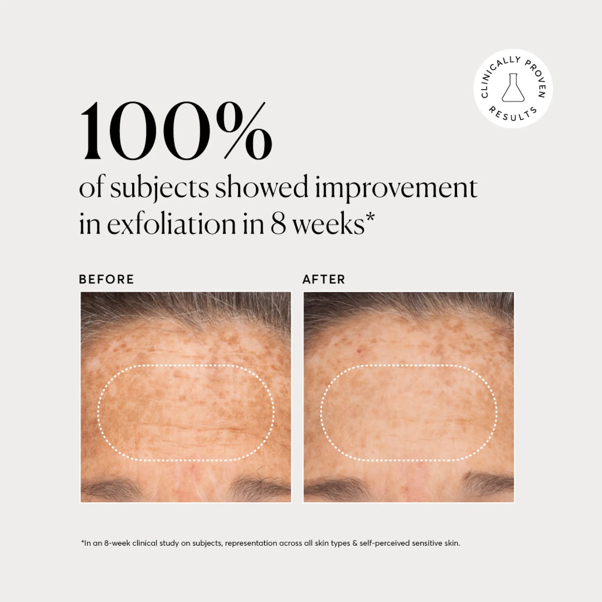 bha-liquid-exfoliant-2-z5 NATR-10027-Alt-Images-BHA-Liquid-Exfoliant-2_-03.webp