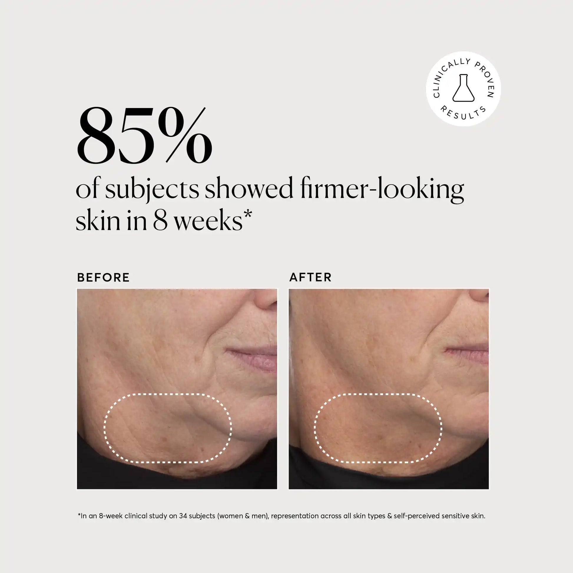 retinol-complex-serum-x3 NATR-10034-Alt-Images-Retinol-Complex-Serum-04.webp
